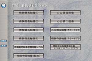 経胸壁心エコー図は動画が多数用意されています。