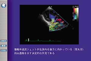 重要ポイントを静止画で確認でき，適切なコメントが表示されます。