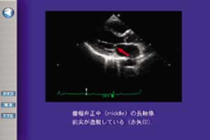 重要ポイントを静止画で確認でき，注目部位が矢印で表示されます。