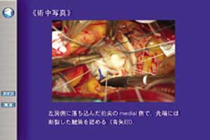 症例により手術写真が提示されます。