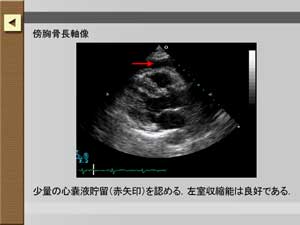 解説ボタンを押すと画像の解説が見られます。静止画では重要なポイントを矢印で示してあります。