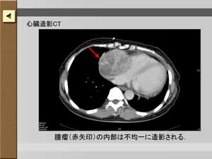 症例のCT画像が見られます。
