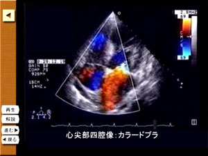 多数のエコーの動画が用意されています。「進む」ボタンで症例ごとの心エコー図画像を連続でみることができます。