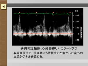解説ボタンを押すと画像の解説が見られます。静止画では重要なポイントを矢印で示してあります。