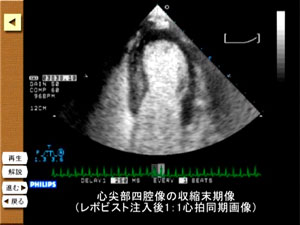 心筋コントラストエコー図が収録されています。