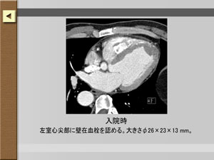 症例のCT画像が見られます。
